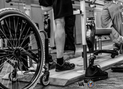 Black and white image of Veteran Patient standing with a implanted prosthetic, a close up of the legs and wheel chair.