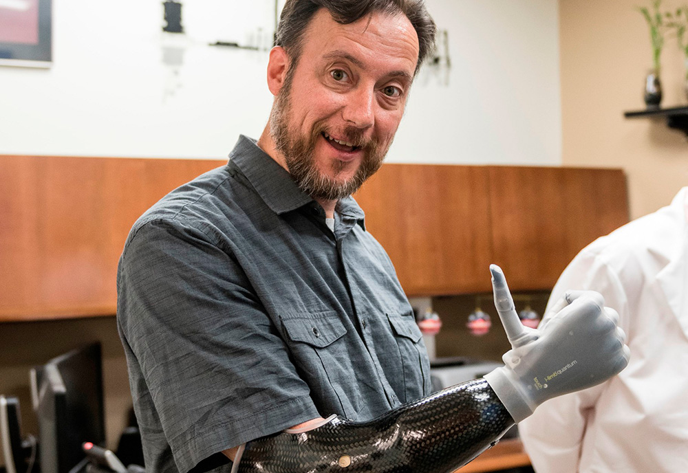 Veteran Daniel Glanz shows off the new prosthetic hand, an iLimb Quantum