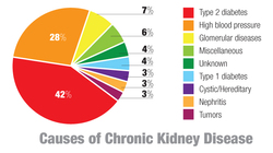 pie chart of causes of kidney disease: Type 2 diabetes causes 42% of kidney disease.  High Blood pressure causes 28%. Glomerular diseases cause 7%. Miscellaneous items cause 6%.  4% of chronic kidney disease are from unknown causes. Type 1 diabetes causes 4%.  Cystic or hereditary problems cause 3%.  Nephritis and Tumors each cause 3% of chronic kidney disease. 