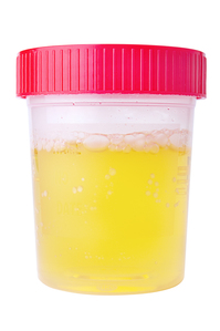 urine in a test cup