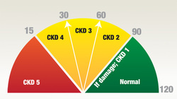Chronic kidney disease stages by eGFR value. Stage 1 has a GFR of 90 or greater. Stage 2 has a GFR range of 60 to 90, Stage 3 has a GFR range of 30 to 59. Stage 4 has a GFR range of 15 to 29 and Stage 5 has a GFR of 15 or less