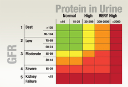 Protein in urine chart.  Having protein in urine over 2000 is very high no matter what your GFR is.  Having a protein level of 300 to 2000 is considered very high, but more so if your GFR is less than 59.  Having protein levels of 30 to 299 is high but goes to very high if your GFR is less than 59.  Protein levels at 10 to 29 is normal if your GFR is more than 60, high if your GFR is 45 to 59 and very high if your GFR is less than 44.  Protein levels less than 10 is normal for GFR more than 60.  It is high when the GFR is 45 to 59 and very high for GFR less than 44. 