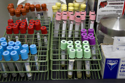 test tubes of blood samples in the lab