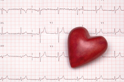 EKG printout with a heart graphic on it