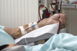 hemodialysis access in patient's left arm