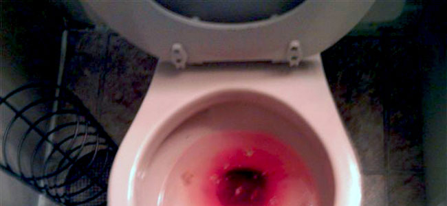 There was blood in my poop. I spent months trying to get a colonoscopy appointment through the VA. - Michael B.