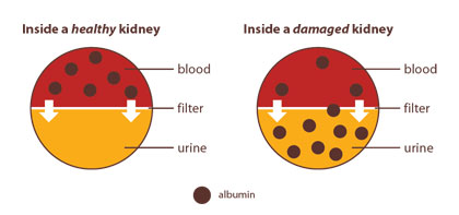 Diagram of a Kidney