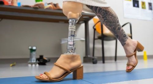 Minneapolis VA's custom prosthetic legs for women embrace style and function