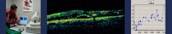 An OCT instrument, a scan of a retina, and a line graph.