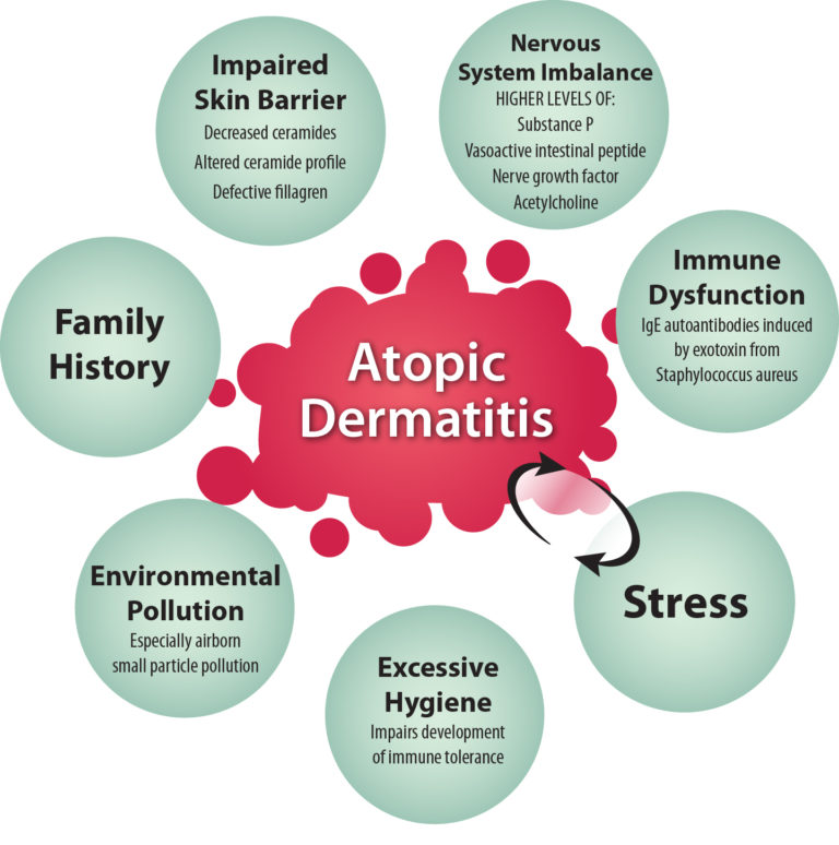 Atopic Dermatitss