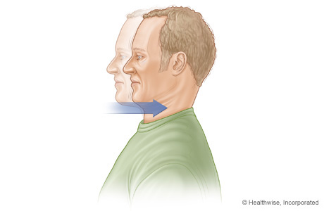 Illustration of human profile from the shoulders up. Lighter illustration has a forward head with sharper illustration of the head back. There is an arrow pointing at the next motioning toward a backward movement.