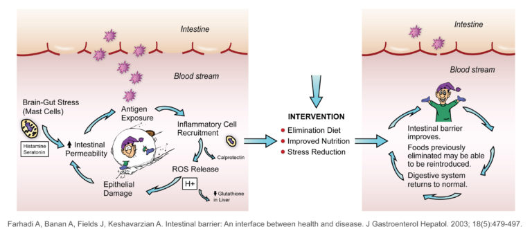 Graphic of the intestinal barrier where on the left side of the graphic there shows cycle of Brain-Gut Stress leading to Intestinal Permeability leading to Antigen exposure leading to Inflammatory cell recruitment leading to ROS Release leading to epithelial damage and back to intestinal permeability. This cycle shows a break in the intestinal barrier allowing blood flow through the barrier. In the middle of the graphic is the header "Intervention" with three bullets points of elimination diet, improved nutrition and stress reduction under it. On the right side of the graphic shows again a circle of movement but showing that with Intervention and the three bullet points intestinal barrier improves. Foods previously eliminated may be able to be reintroduced. Digestive system returns to normal. The graphic also shows a barrier between the Intestine and the blood stream with only one section broken. Graphic is found in Farhadi A, Banan A, Fields J, Keshavarzian A. Intestinal barrier: An interface between health and disease. In Journal of Gastroenterology and Hepatology. 2003. Volume 18, Issue 5, pages 479-497.