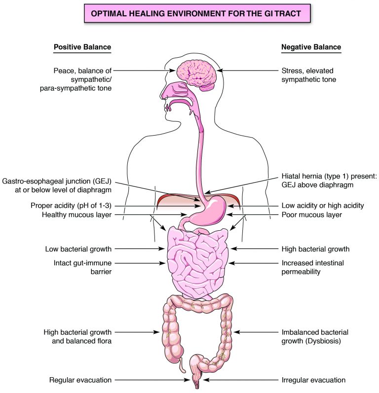 Drawing of the Optimal Healing Environment for the GI Tract with images of internal human organs conveying positive and negative balance. Positive balance includes: Peace, balance of sympathetic/para-sympathetic tone; Gastro-esophageal junction (G.E.J.) at or below level of diaphragm; Proper acidity (pH of 1-3) Healthy mucous layer; Low bacterial growth; Intact gut-immune barrier; High bacterial growth and balance flora; and Regular evacuation. Negative Balance includes: Stress, elevated sympathetic tone; Hiatal hernia (type 1) present: GEJ above diaphragm; Low acidity or high acidity; Poor mucous layer; High bacterial growth; Increased intestinal permeability; Imbalanced bacterial growth (Dysbiosis); and Irregular evacuation.
