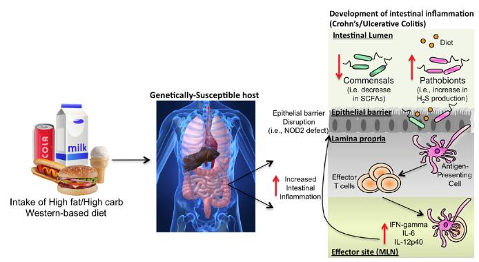 Computer graphic showing the intake of a high fat/high carb Western-based diet in a genetically-suspetible host (image of internal organs of a human midsection) can lead to the development of intestinal inflammation (Crohn's/Ulcerative Colitis).