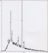 Energy dispersive X-ray spectra (Figure 4) obtained from these particles contained peaks for titanium, phosphorus, calcium, and sulfur. 