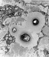 Ultrastructurally, several yeasts had prominent capsules with radiating, corona-like fibrillar material typical of Cryptococcus (Figures 1, 2, & 3). 
