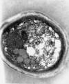 Ultrastructurally, several yeasts had prominent capsules with radiating, corona-like fibrillar material typical of Cryptococcus (Figures 1, 2, & 3). 