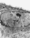 electron microscopy also showed sparse spirochetes had invaded the mucosal epithelium and were present in goblet cells (Figures 1 & 2) and enterocytes. 