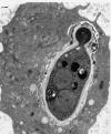 In Figure 2 a yeast with a single bud is present in a neutrophil.